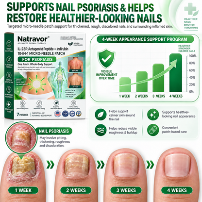 🔥 Only 10 left! Get 30% OFF your second purchase! Natravor® helps reduce visible scaling, redness, dryness & itching while supporting psoriasis-prone skin. Limited stock — don’t miss out! 💚