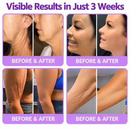 Natravor®🎗️ PDRN Multi-Peptide Firming Body Cream | Anti-Aging Skincare, Deep Hydration, Firming & Lifting Care for Smoother, More Radiant-Looking Skin