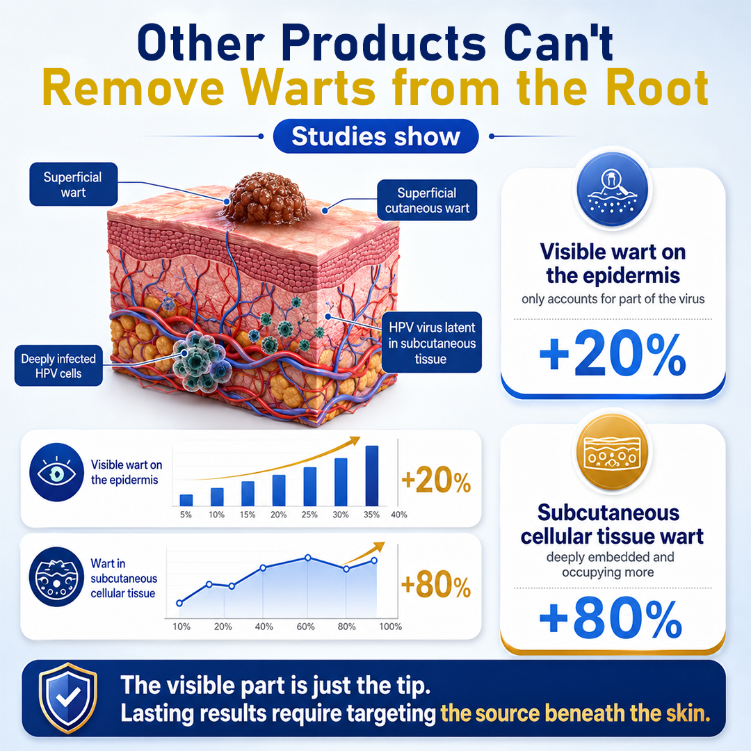 Zero Pain💎Natravor® Cryotherapy Wart Remover Spray（Botanical Extracts · Advanced Cryotherapy Technology · Targeted Care for Warts & Skin Bumps）