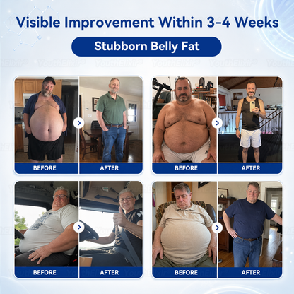 🌱Natravor® Metabolism Navel Drops  —（⌚️𝟥𝟢-𝖲𝖾𝖼𝗈𝗇𝖽 𝖭𝗂𝗀𝗁𝗍𝗍𝗂𝗆𝖾 𝖱𝗂𝗍𝗎𝖺𝗅 𝖿𝗈𝗋 𝖬𝖾𝗍𝖺𝖻𝗈𝗅𝗂𝖼 𝖡𝖺𝗅𝖺𝗇𝖼𝖾🍃, 𝖫𝗒𝗆𝗉𝗁𝖺𝗍𝗂𝖼 𝖲𝗎𝗉𝗉𝗈𝗋𝗍, 𝖡𝗅𝗈𝖺𝗍𝗂𝗇𝗀 𝖱𝖾𝗅𝗂𝖾𝖿 & 𝖥𝗂𝗋𝗆𝖾𝗋-𝖫𝗈𝗈𝗄𝗂𝗇𝗀 𝖲𝗄𝗂𝗇）🌱