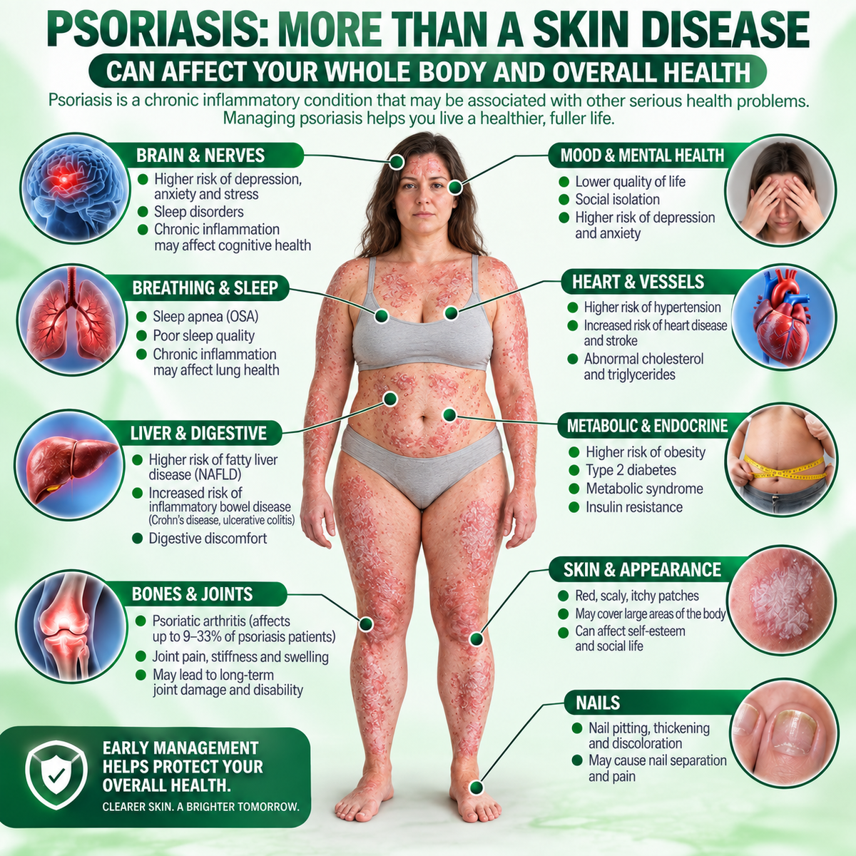 🔥 Only 10 left! Get 30% OFF your second purchase! Natravor® helps reduce visible scaling, redness, dryness & itching while supporting psoriasis-prone skin. Limited stock — don’t miss out! 💚