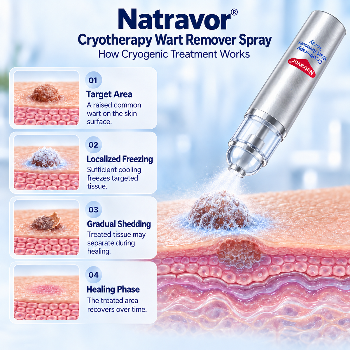 Zero Pain💎Natravor® Cryotherapy Wart Remover Spray（Botanical Extracts · Advanced Cryotherapy Technology · Targeted Care for Warts & Skin Bumps）