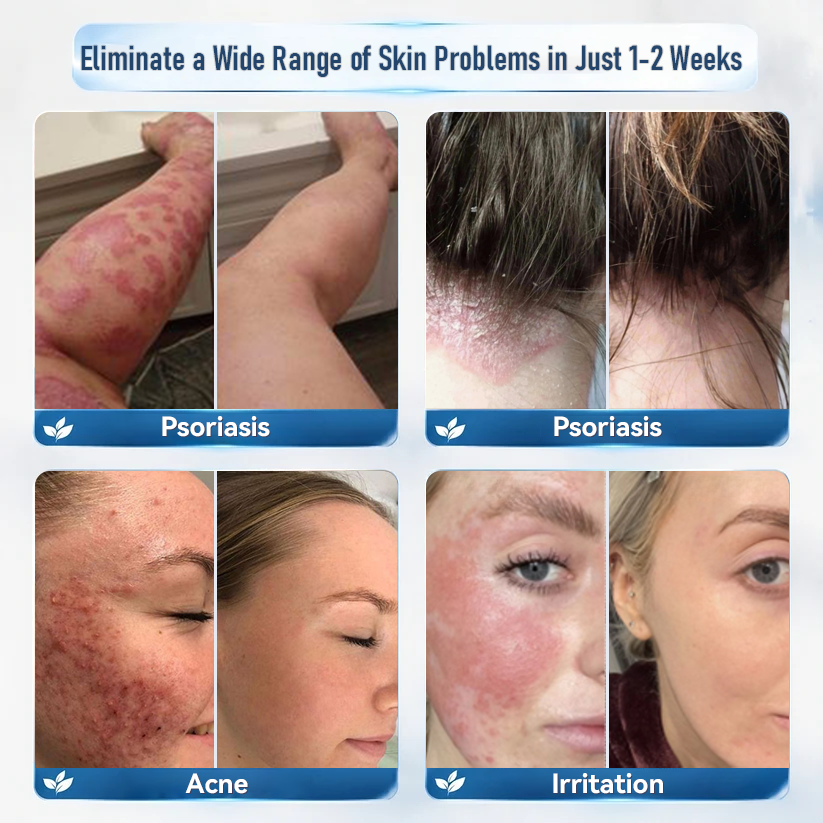 Natravor® 7-Day Skin Renewal Repair Cream — Soothe Itching, Then Restore (Gentle, Pain-Free Skin Repair Formula) 💎